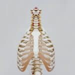 Sirenomelia A rare genetic development syndrome