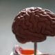 Neurodegeneration and brain disorders